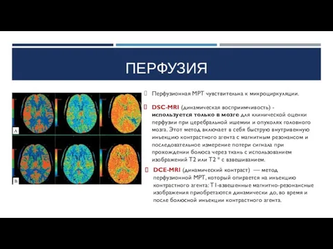 ПЕРФУЗИЯ DCE-MRI (динамический контраст) — метод перфузионной МРТ, который опирается на инъекцию