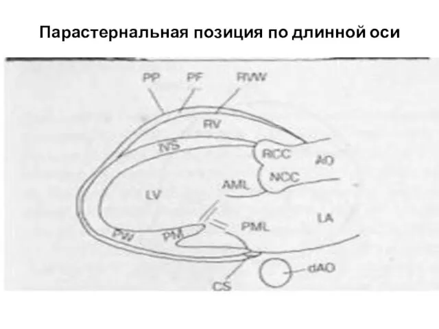 Парастернальная позиция по длинной оси