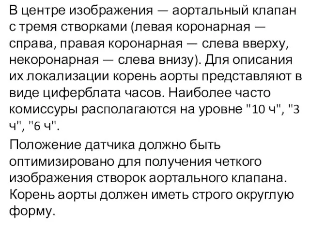 В центре изображения — аортальный клапан с тремя створками (левая коронарная —