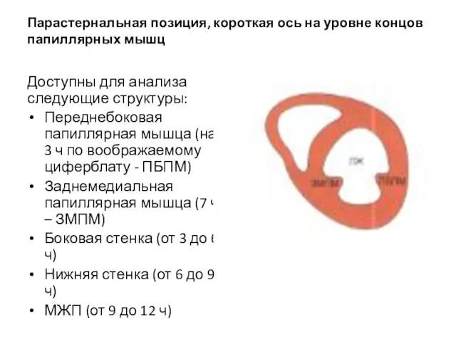 Парастернальная позиция, короткая ось на уровне концов папиллярных мышц Доступны для анализа