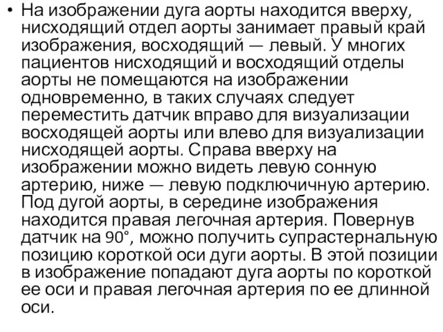 На изображении дуга аорты находится вверху, нисходящий отдел аорты занимает правый край