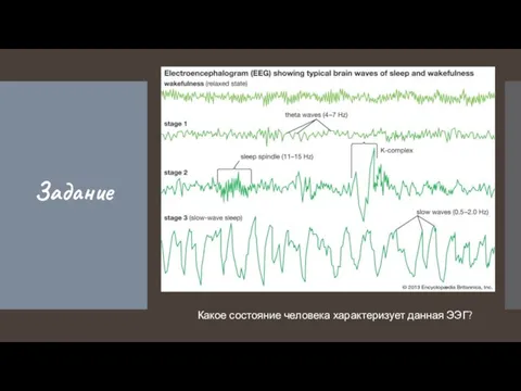 Задание Какое состояние человека характеризует данная ЭЭГ?