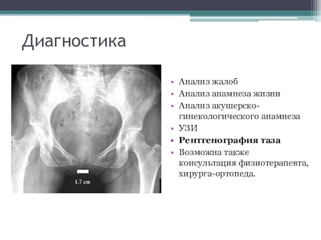 Диагностика Анализ жалоб Анализ анамнеза жизни Анализ акушерско-гинекологического анамнеза УЗИ Рентгенография таза