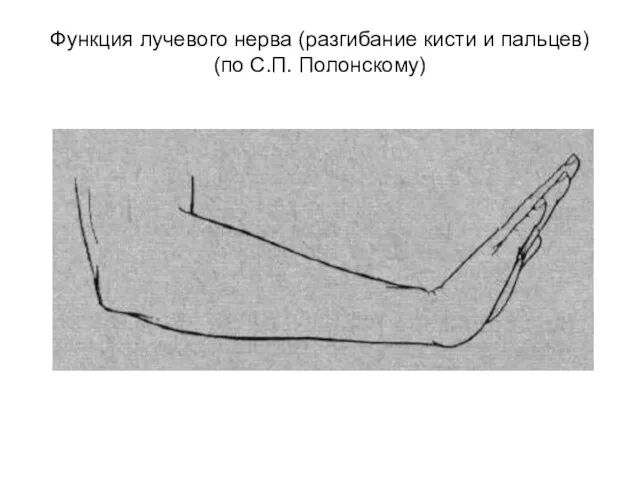 Функция лучевого нерва (разгибание кисти и пальцев) (по С.П. Полонскому)