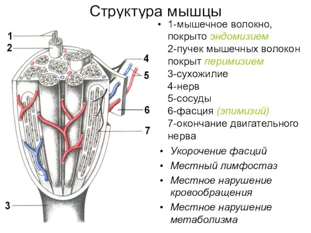 Структура мышцы Укорочение фасций Местный лимфостаз Местное нарушение кровообращения Местное нарушение метаболизма