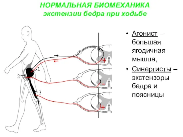 НОРМАЛЬНАЯ БИОМЕХАНИКА экстензии бедра при ходьбе Агонист – большая ягодичная мышца, Синергисты