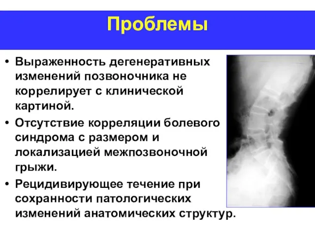 Проблемы Выраженность дегенеративных изменений позвоночника не коррелирует с клинической картиной. Отсутствие корреляции