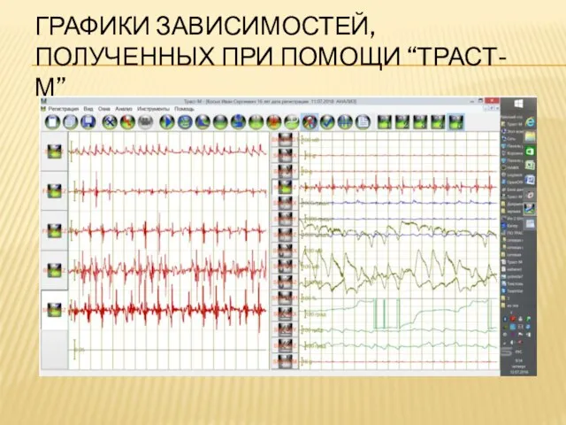 ГРАФИКИ ЗАВИСИМОСТЕЙ, ПОЛУЧЕННЫХ ПРИ ПОМОЩИ “ТРАСТ-М”