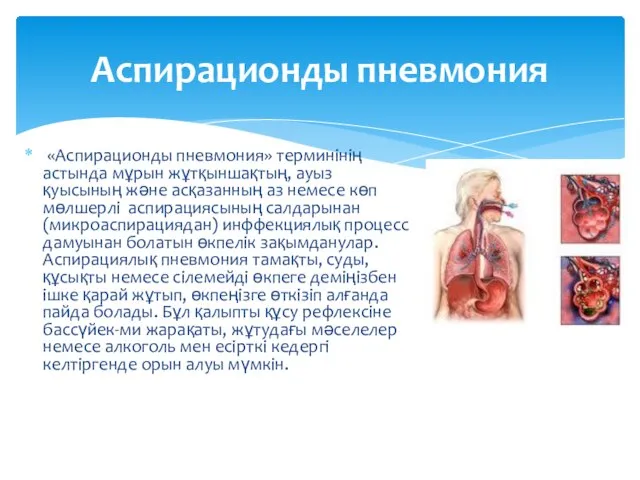 «Аспирационды пневмония» терминінің астында мұрын жұтқыншақтың, ауыз қуысының және асқазанның аз немесе