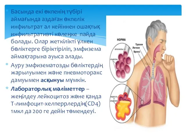 Басында екі өкпенің түбірі аймағында аздаған өкпелік инфильтрат ал кейіннен ошақтық инфильтративті