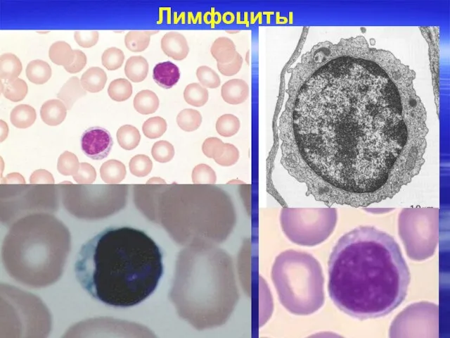 Лимфоциты