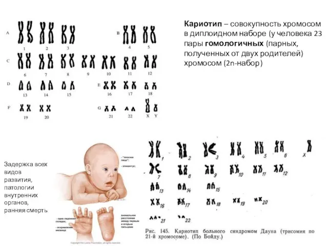 Кариотип – совокупность хромосом в диплоидном наборе (у человека 23 пары гомологичных
