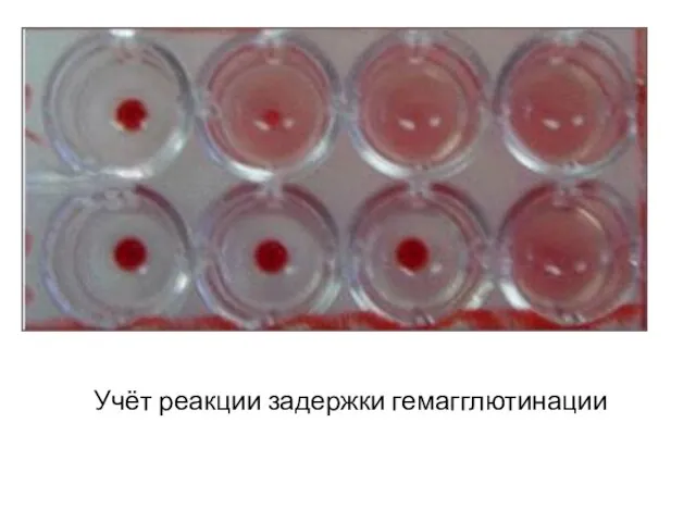 Учёт реакции задержки гемагглютинации