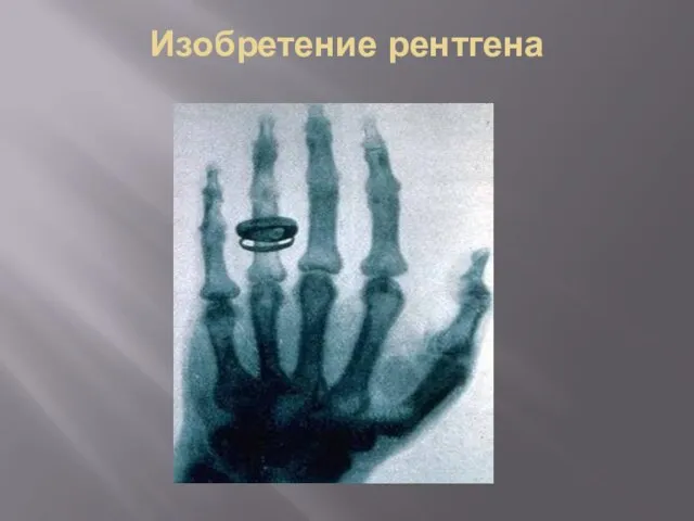 Изобретение рентгена