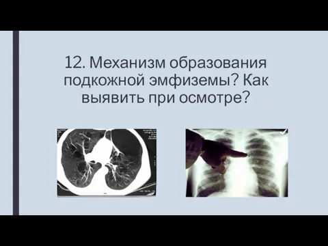 12. Механизм образования подкожной эмфиземы? Как выявить при осмотре?