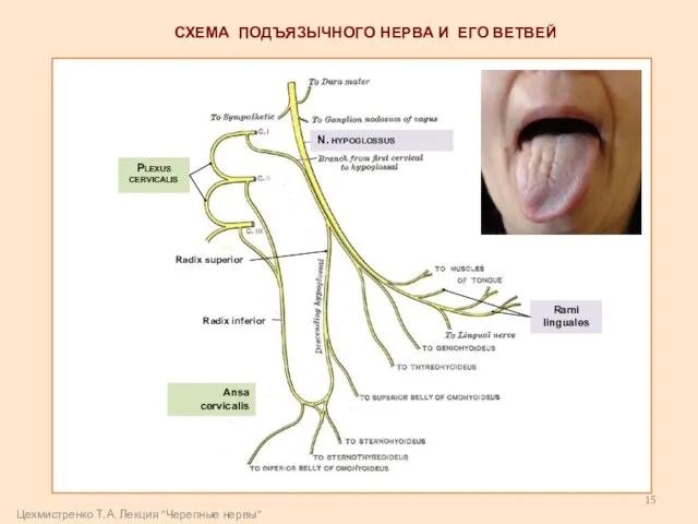 СХЕМА ПОДЪЯЗЫЧНОГО НЕРВА И ЕГО ВЕТВЕЙ Rami linguales Radix superior Radix inferior