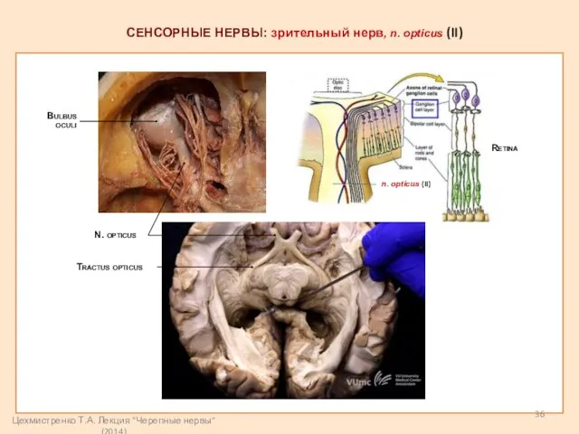 СЕНСОРНЫЕ НЕРВЫ: зрительный нерв, n. opticus (II) n. opticus (II) N. opticus