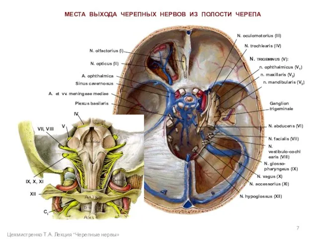 МЕСТА ВЫХОДА ЧЕРЕПНЫХ НЕРВОВ ИЗ ПОЛОСТИ ЧЕРЕПА N. oculomotorius (III) N. trochlearis