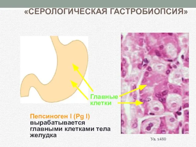 «СЕРОЛОГИЧЕСКАЯ ГАСТРОБИОПСИЯ» Пепсиноген I (Pg I) вырабатывается главными клетками тела желудка Главные клетки Ув. х480