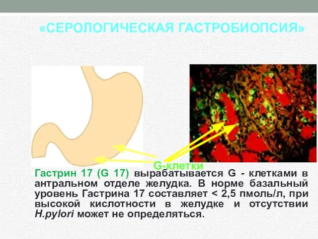 Гастрин 17 (G 17) вырабатывается G - клетками в антральном отделе желудка.