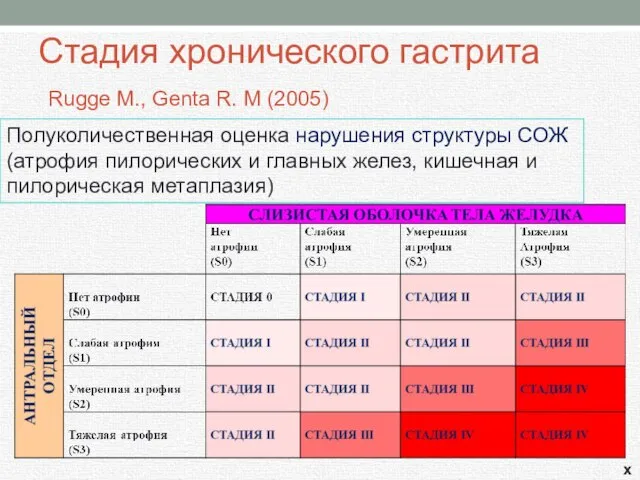 Стадия хронического гастрита Rugge M., Genta R. M (2005) Полуколичественная оценка нарушения