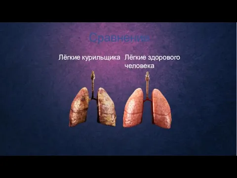 Сравнение Лёгкие курильщика Лёгкие здорового человека