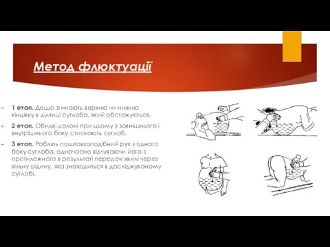 Метод флюктуації 1 етап. Дещо згинають верхню чи нижню кінцівку в ділянці