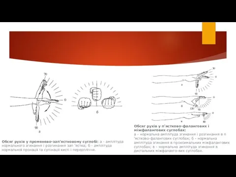 Обсяг рухів у променево-зап'ястковому суглобі: а - амплітуда нормального згинання і розгинання