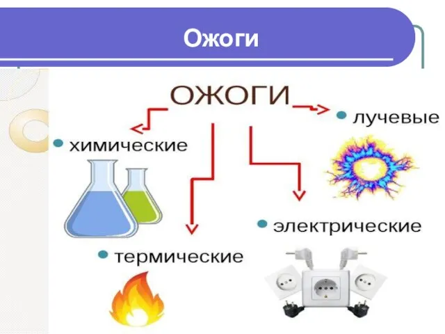 Ожоги