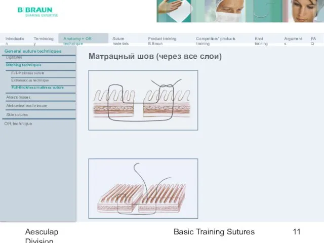 Basic Training Sutures Aesculap Division Матрацный шов (через все слои) General suture