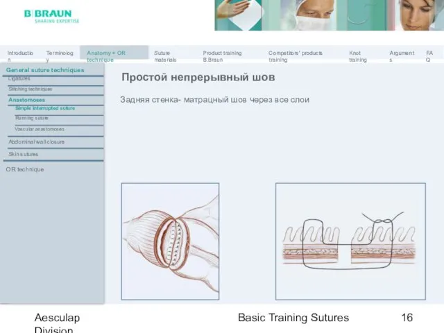 Basic Training Sutures Aesculap Division Задняя стенка- матрацный шов через все слои