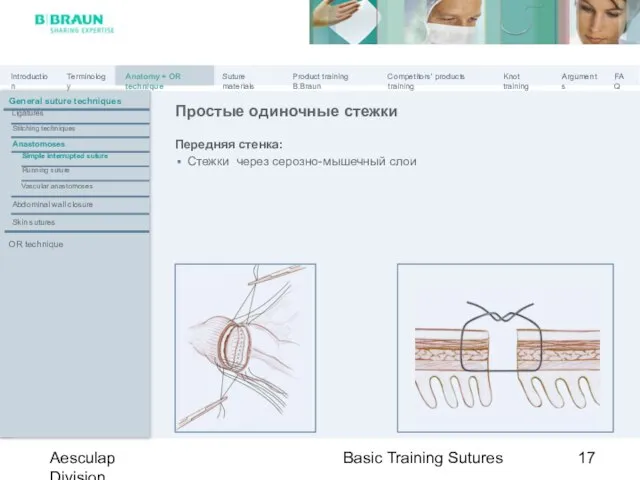 Basic Training Sutures Aesculap Division Простые одиночные стежки Передняя стенка: Стежки через