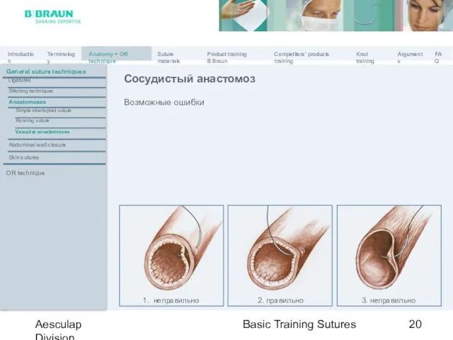 Basic Training Sutures Aesculap Division Возможные ошибки Сосудистый анастомоз 2. правильно General