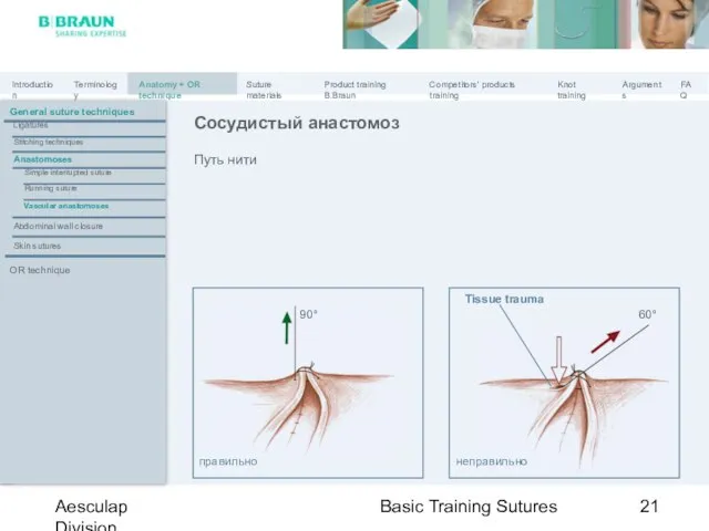 Basic Training Sutures Aesculap Division Путь нити Сосудистый анастомоз правильно неправильно 90°