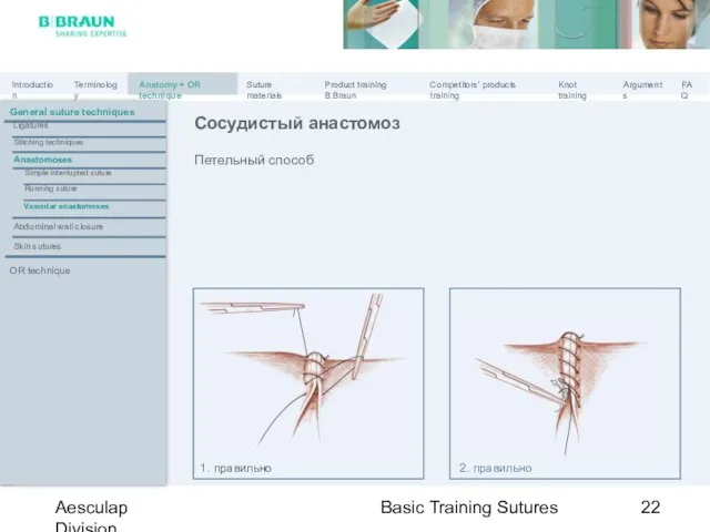 Basic Training Sutures Aesculap Division Петельный способ Сосудистый анастомоз 1. правильно 2.