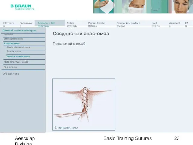 Basic Training Sutures Aesculap Division Петельный способ Сосудистый анастомоз 3. неправильно General