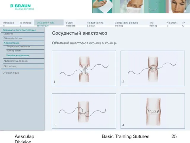 Basic Training Sutures Aesculap Division Обвивной анастомоз «конец в конец» Сосудистый анастомоз