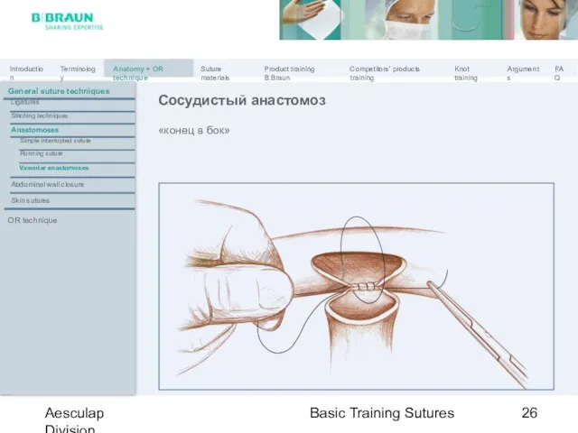 Basic Training Sutures Aesculap Division «конец в бок» Сосудистый анастомоз General suture