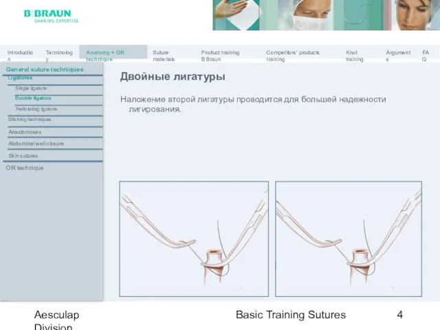 Basic Training Sutures Aesculap Division Двойные лигатуры Наложение второй лигатуры проводится для