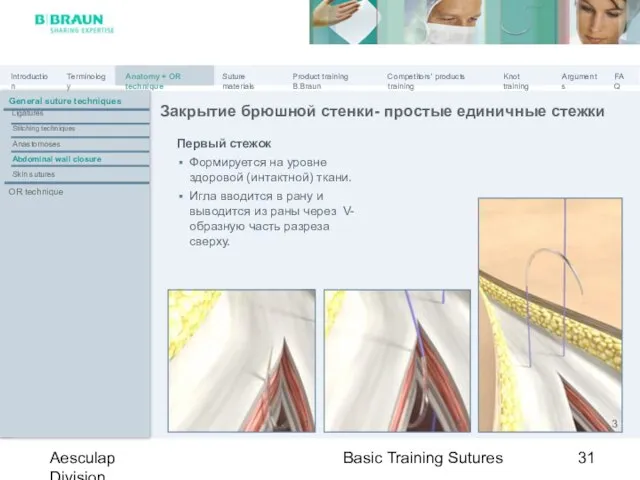 Basic Training Sutures Aesculap Division Первый стежок Формируется на уровне здоровой (интактной)