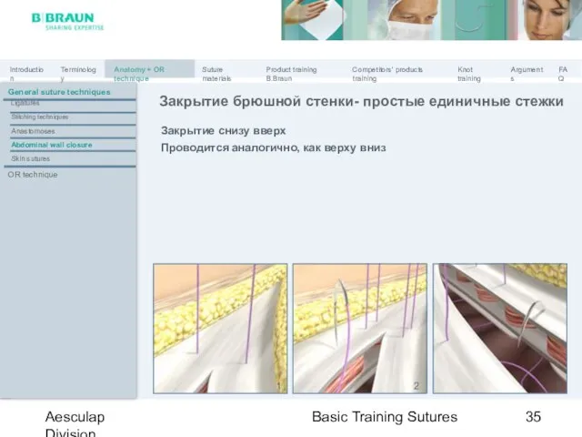 Basic Training Sutures Aesculap Division Закрытие снизу вверх Проводится аналогично, как верху