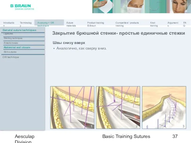 Basic Training Sutures Aesculap Division Швы снизу вверх Аналогично, как сверху вниз.