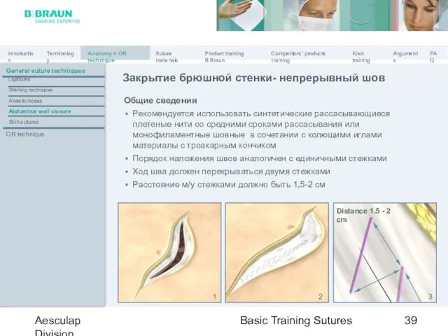 Basic Training Sutures Aesculap Division Закрытие брюшной стенки- непрерывный шов General suture