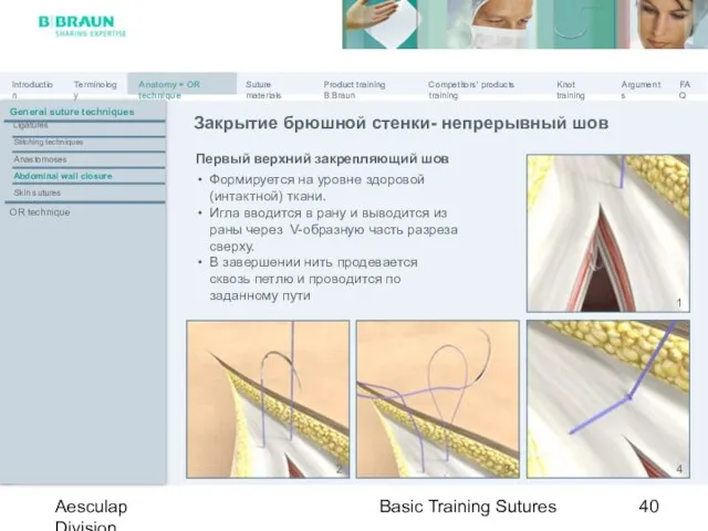 Basic Training Sutures Aesculap Division Первый верхний закрепляющий шов Формируется на уровне