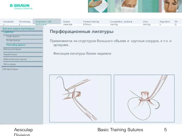 Basic Training Sutures Aesculap Division Перфорационные лигатуры Применяются на структурах большого объема