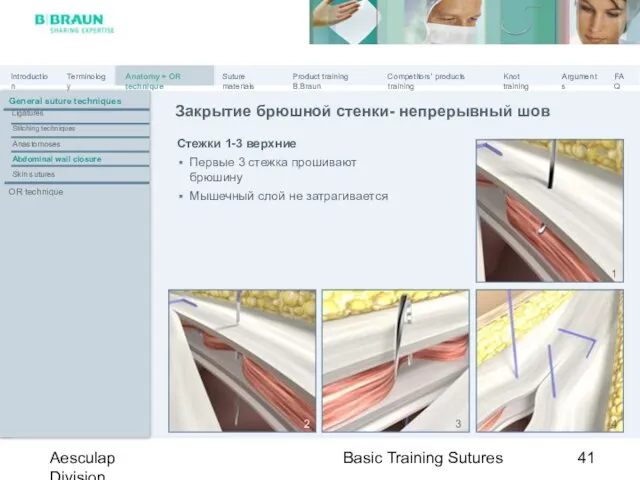 Basic Training Sutures Aesculap Division Стежки 1-3 верхние Первые 3 стежка прошивают