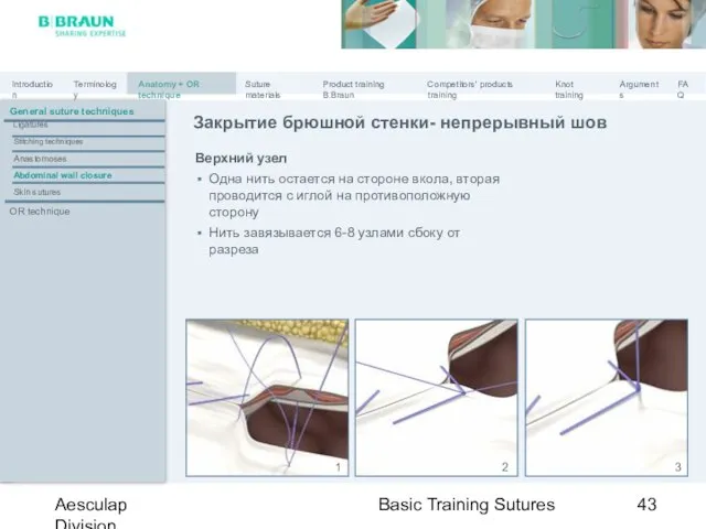 Basic Training Sutures Aesculap Division Верхний узел Одна нить остается на стороне