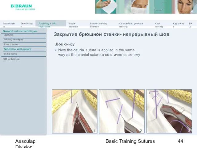 Basic Training Sutures Aesculap Division Шов снизу Now the caudal suture is