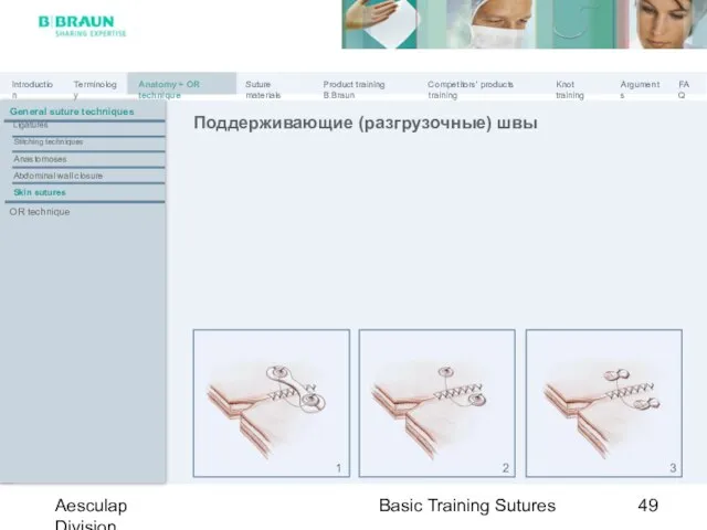 Basic Training Sutures Aesculap Division Поддерживающие (разгрузочные) швы 1 2 3 General