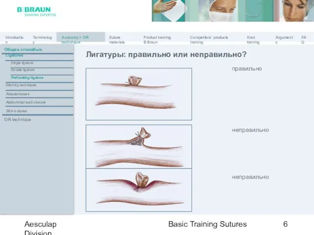 Basic Training Sutures Aesculap Division Лигатуры: правильно или неправильно? правильно неправильно Общие